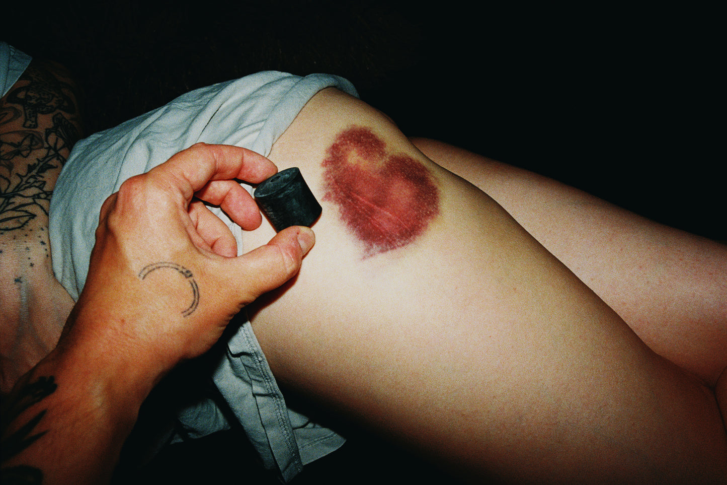 Heart-Shaped Bruise Signed Print