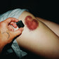 Heart-Shaped Bruise Signed Print